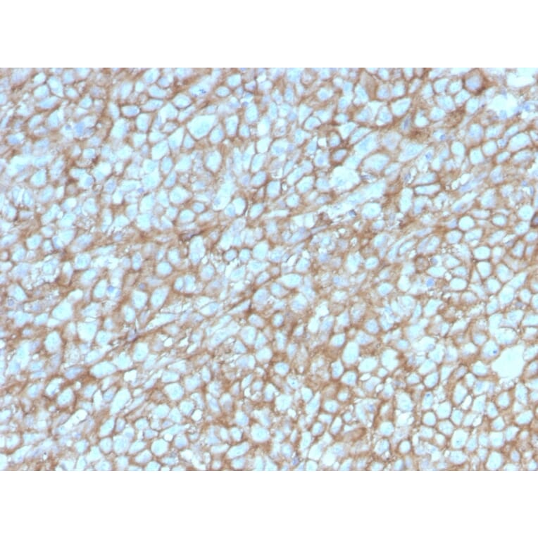 Immunohistochemistry - Anti-CD146 Antibody [MCAM/3048] (A249296) - Antibodies.com
