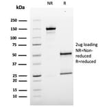 SDS-PAGE - Anti-CD146 Antibody [MCAM/3179] (A249297) - Antibodies.com
