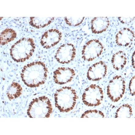 Immunohistochemistry - Anti-MCM6 Antibody [MCM6/2999] (A249298) - Antibodies.com