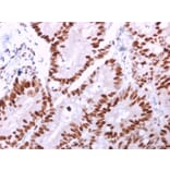 Immunohistochemistry - Anti-MCM6 Antibody [MCM6/2999] (A249298) - Antibodies.com