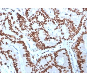 Immunohistochemistry - Anti-MCM6 Antibody [MCM6/3000] (A249299) - Antibodies.com