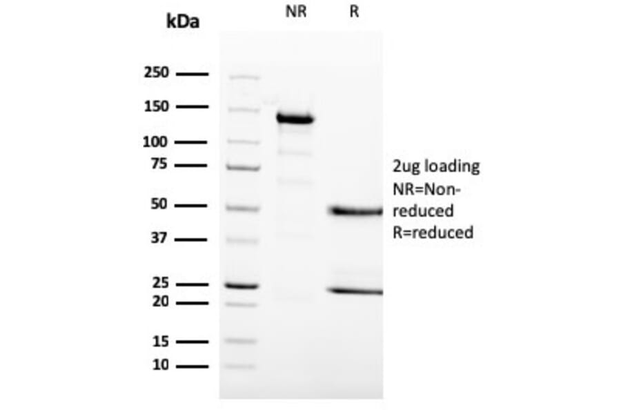 SDS-PAGE - Anti-MCM6 Antibody [MCM6/3000] (A249299) - Antibodies.com