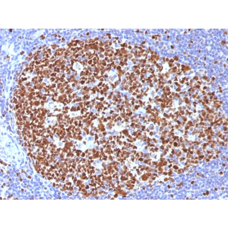 Immunohistochemistry - Anti-MCM7 Antibody [MCM7/1466] (A249299) - Antibodies.com