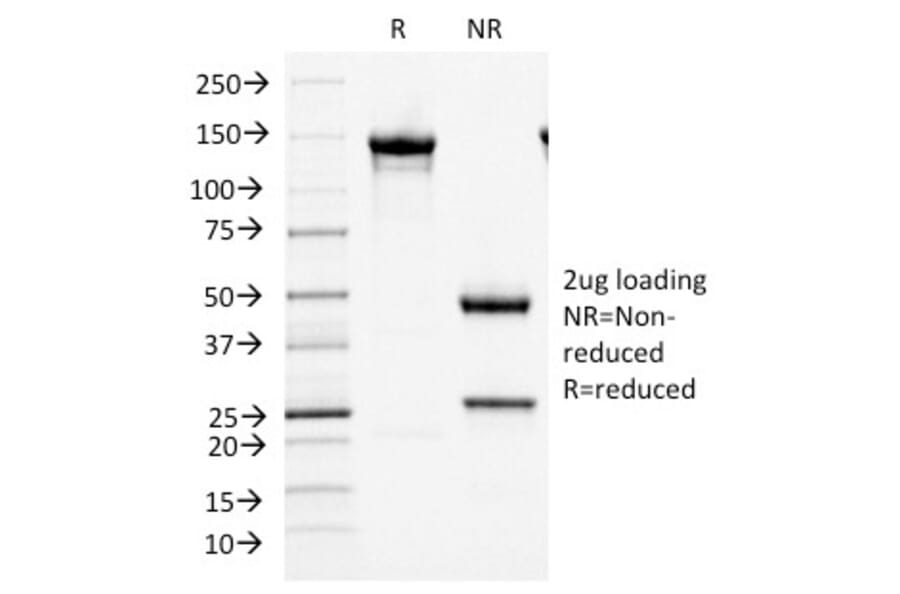 SDS-PAGE - Anti-MCM7 Antibody [MCM7/1466] (A249300) - Antibodies.com
