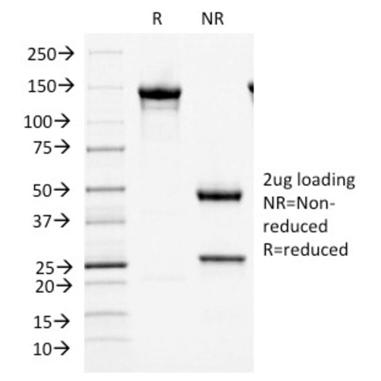 SDS-PAGE - Anti-MCM7 Antibody [MCM7/1466] (A249300) - Antibodies.com