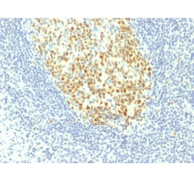 Immunohistochemistry - Anti-MCM7 Antibody [MCM7/1467] (A249301) - Antibodies.com