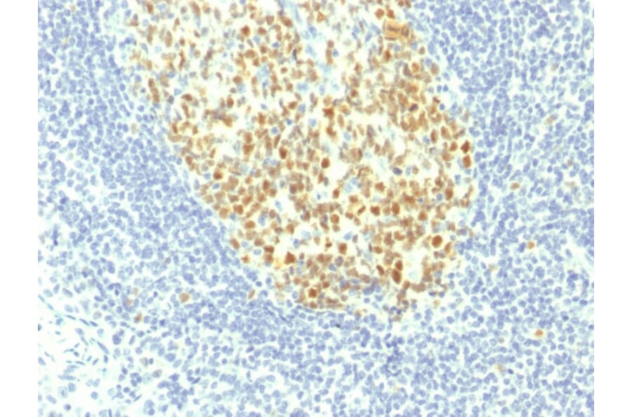 Immunohistochemistry - Anti-MCM7 Antibody [MCM7/1467] (A249301) - Antibodies.com