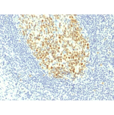 Immunohistochemistry - Anti-MCM7 Antibody [MCM7/1467] (A249301) - Antibodies.com