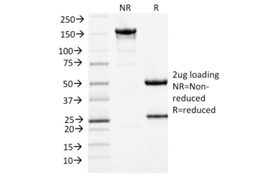 SDS-PAGE - Anti-MCM7 Antibody [MCM7/1467] (A249301) - Antibodies.com