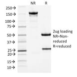 SDS-PAGE - Anti-MCM7 Antibody [MCM7/1467] (A249301) - Antibodies.com