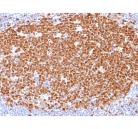 Immunohistochemistry - Anti-MCM7 Antibody [MCM7/1468] (A249302) - Antibodies.com