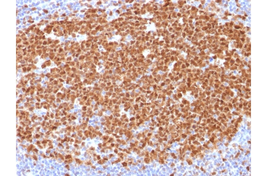 Immunohistochemistry - Anti-MCM7 Antibody [MCM7/1468] (A249302) - Antibodies.com