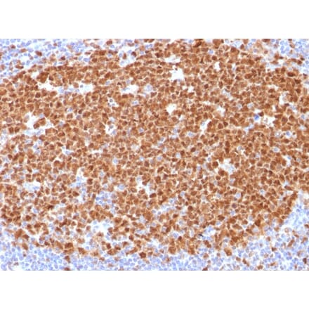 Immunohistochemistry - Anti-MCM7 Antibody [MCM7/1468] (A249302) - Antibodies.com