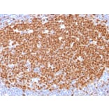 Immunohistochemistry - Anti-MCM7 Antibody [MCM7/1468] (A249302) - Antibodies.com