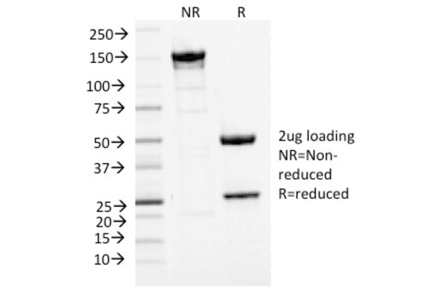 SDS-PAGE - Anti-MCM7 Antibody [MCM7/1468] (A249302) - Antibodies.com