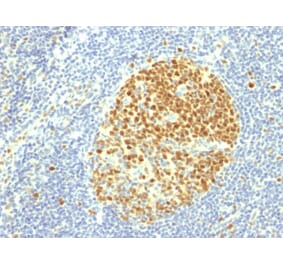 Immunohistochemistry - Anti-MCM7 Antibody [MCM7/1469] (A249303) - Antibodies.com