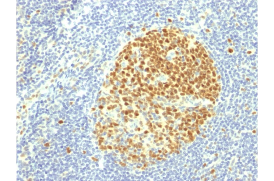 Immunohistochemistry - Anti-MCM7 Antibody [MCM7/1469] (A249303) - Antibodies.com