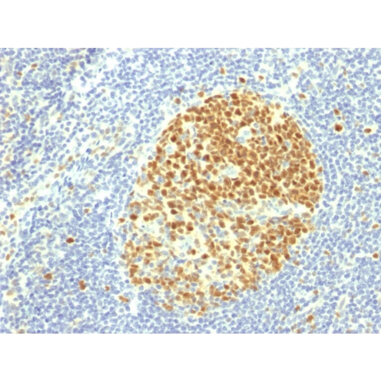 Immunohistochemistry - Anti-MCM7 Antibody [MCM7/1469] (A249303) - Antibodies.com