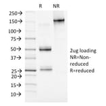 SDS-PAGE - Anti-MCM7 Antibody [MCM7/1469] (A249303) - Antibodies.com