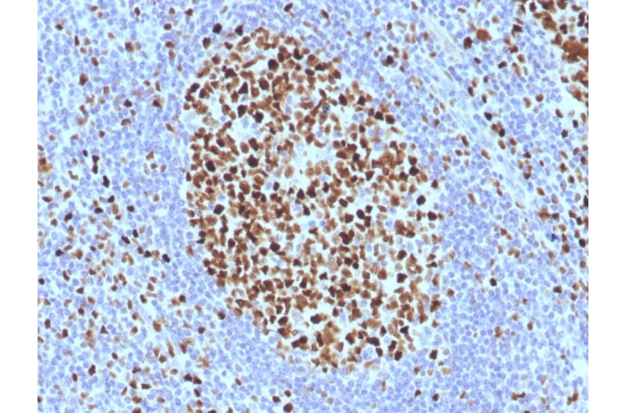 Immunohistochemistry - Anti-MCM7 Antibody [SPM379] (A249303) - Antibodies.com