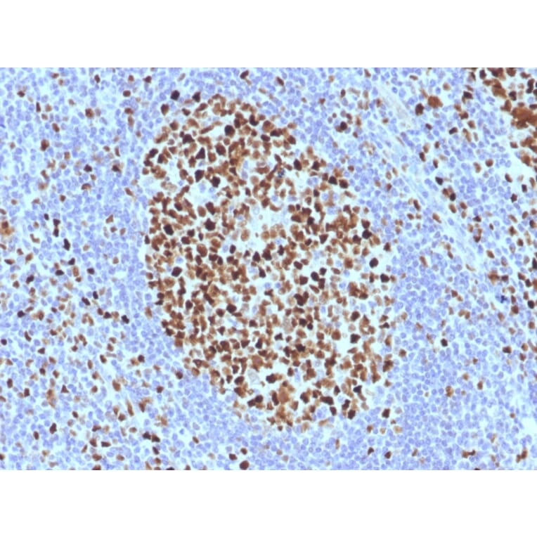 Immunohistochemistry - Anti-MCM7 Antibody [SPM379] (A249303) - Antibodies.com