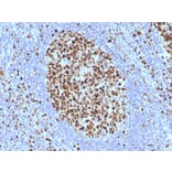 Immunohistochemistry - Anti-MCM7 Antibody [SPM379] (A249303) - Antibodies.com