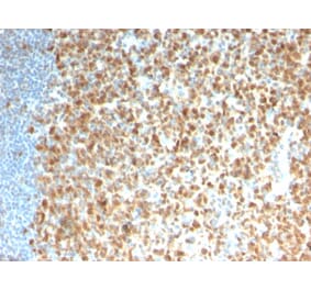Immunohistochemistry - Anti-MCM7 Antibody [rMCM7/1468] (A249305) - Antibodies.com