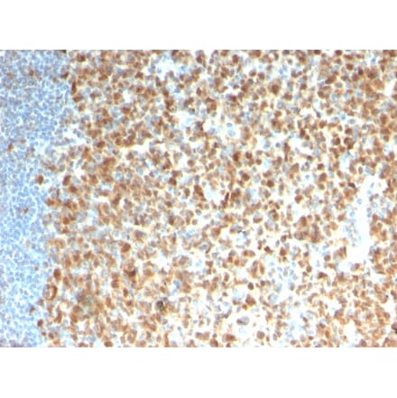Immunohistochemistry - Anti-MCM7 Antibody [rMCM7/1468] (A249305) - Antibodies.com