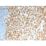 Immunohistochemistry - Anti-MCM7 Antibody [rMCM7/1468] (A249305) - Antibodies.com