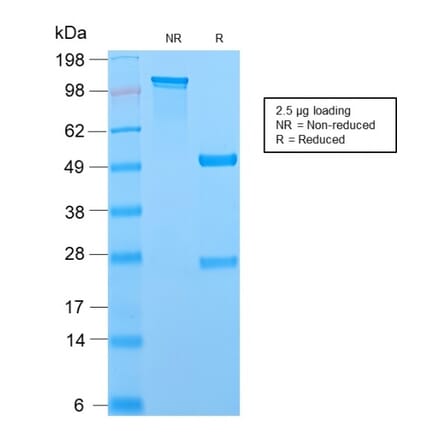 SDS-PAGE - Anti-MCM7 Antibody [MCM7/2756R] (A249306) - Antibodies.com