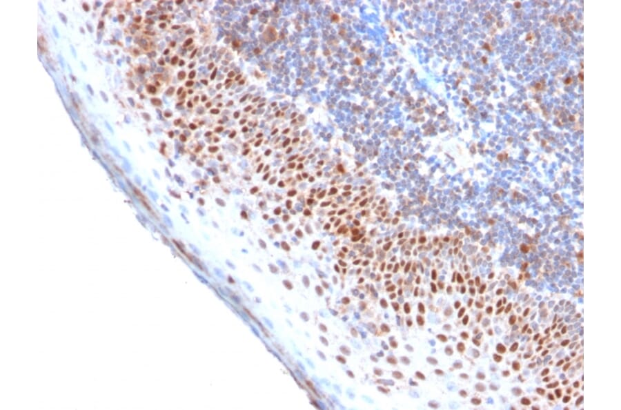 Immunohistochemistry - Anti-MCM7 Antibody [MCM7/2756R] (A249305) - Antibodies.com