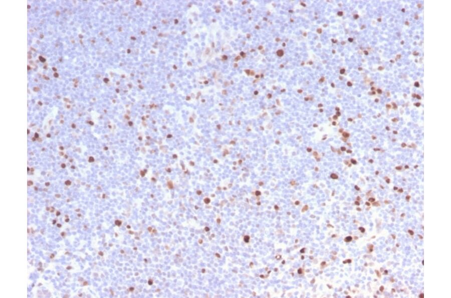 Immunohistochemistry - Anti-MCM7 Antibody [MCM7/2832R] (A249306) - Antibodies.com