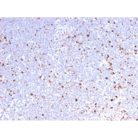 Immunohistochemistry - Anti-MCM7 Antibody [MCM7/2832R] (A249306) - Antibodies.com