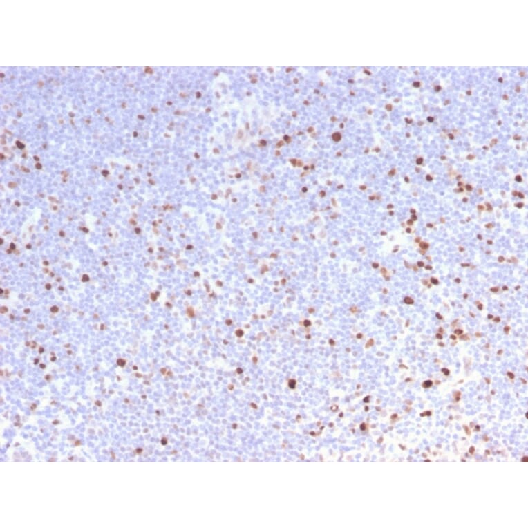 Immunohistochemistry - Anti-MCM7 Antibody [MCM7/2832R] (A249306) - Antibodies.com