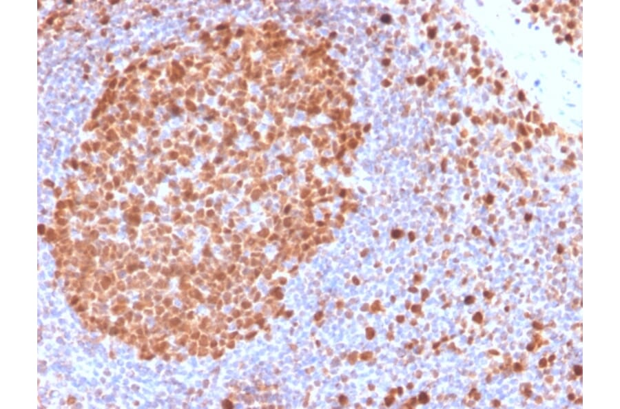 Immunohistochemistry - Anti-MCM7 Antibody [MCM7/2832R] (A249307) - Antibodies.com