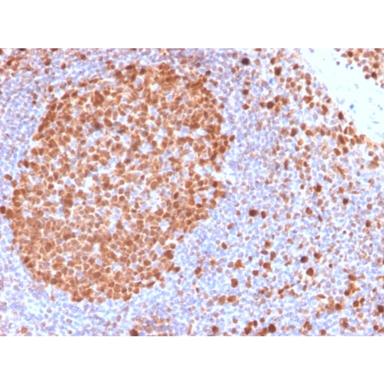 Immunohistochemistry - Anti-MCM7 Antibody [MCM7/2832R] (A249307) - Antibodies.com