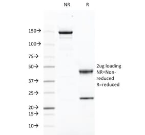 SDS-PAGE - Anti-CD46 Antibody [169-1-E4.3] (A249308) - Antibodies.com
