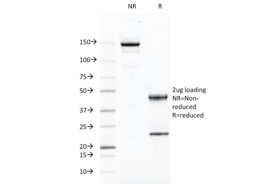 SDS-PAGE - Anti-CD46 Antibody [169-1-E4.3] (A249308) - Antibodies.com