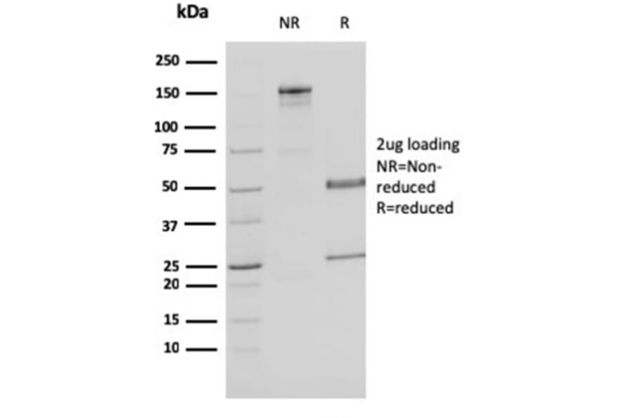 SDS-PAGE - Anti-MDH1 Antibody [CPTC-MDH1-1] (A249309) - Antibodies.com