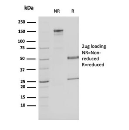 SDS-PAGE - Anti-MDH1 Antibody [CPTC-MDH1-1] (A249309) - Antibodies.com