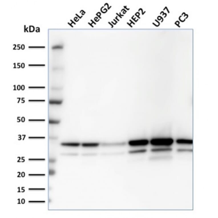 Western Blot - Anti-MDH1 Antibody [CPTC-MDH1-1] (A249311) - Antibodies.com