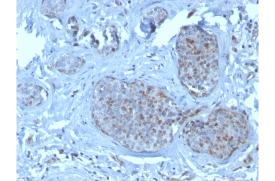 Immunohistochemistry - Anti-MDM2 Antibody [SMP14] (A249311) - Antibodies.com