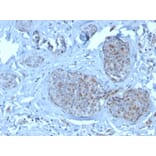 Immunohistochemistry - Anti-MDM2 Antibody [SMP14] (A249311) - Antibodies.com