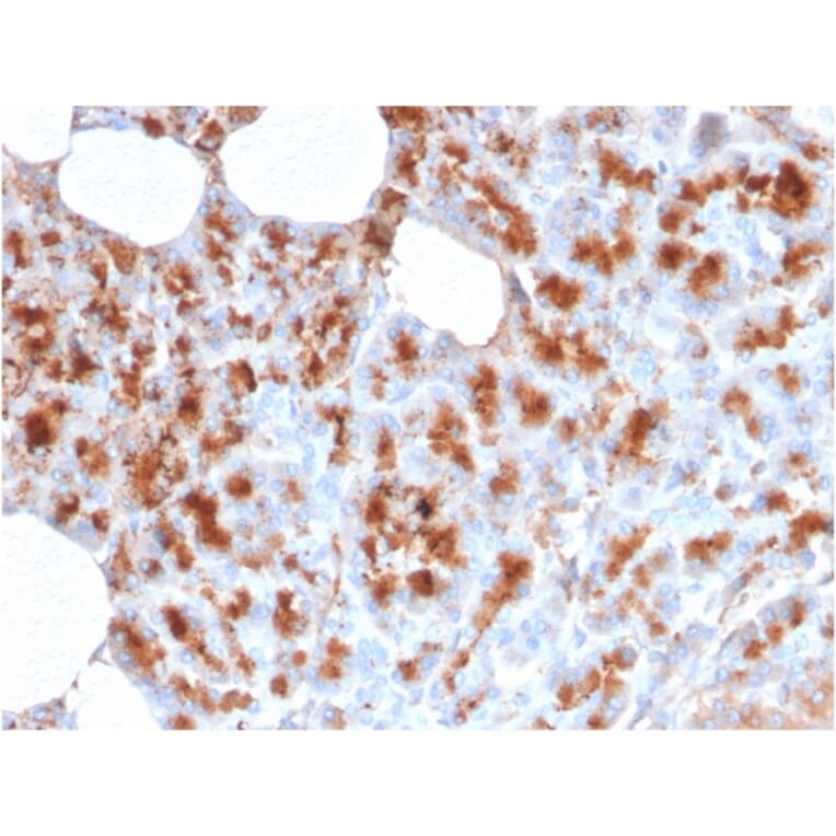 Immunohistochemistry - Anti-MDM2 Antibody [MDM2/2414] (A249313) - Antibodies.com