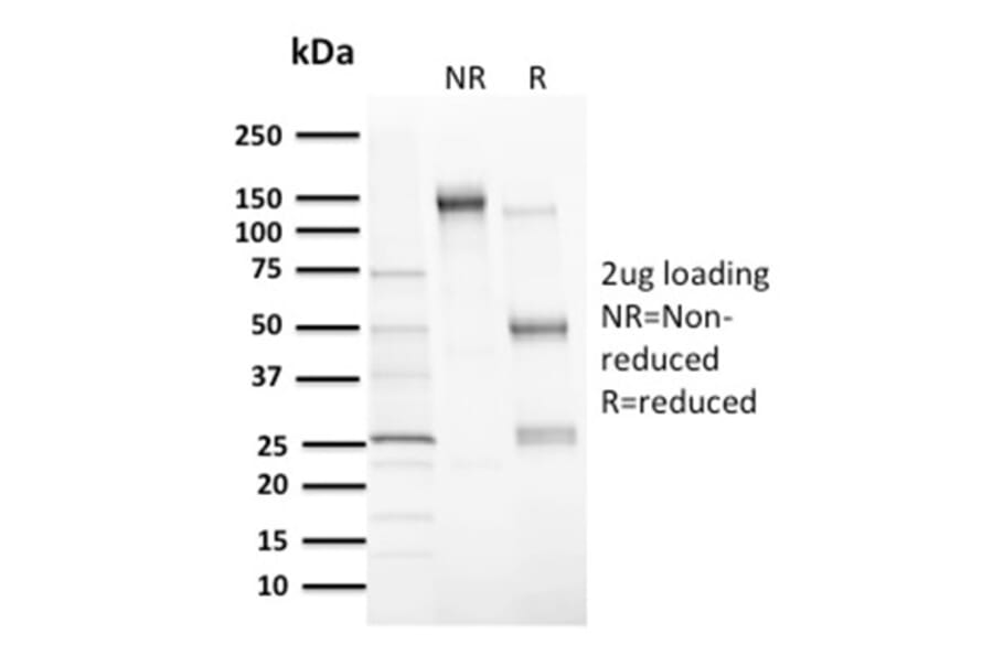 SDS-PAGE - Anti-MDM2 Antibody [MDM2/2414] (A249313) - Antibodies.com