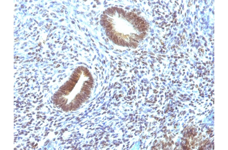 Immunohistochemistry - Anti-MAP3K1 Antibody [2F6] (A249314) - Antibodies.com