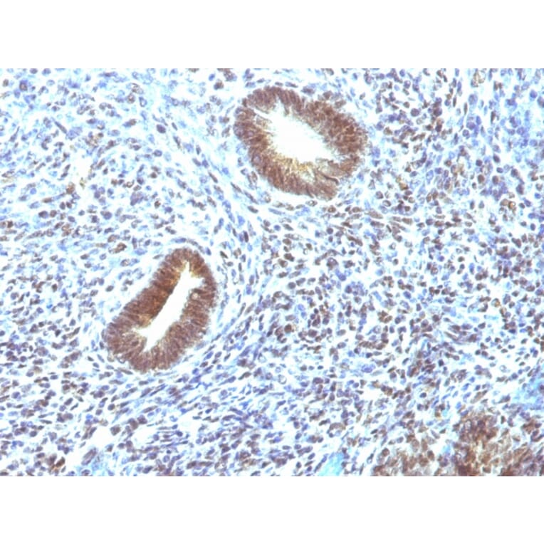 Immunohistochemistry - Anti-MAP3K1 Antibody [2F6] (A249314) - Antibodies.com