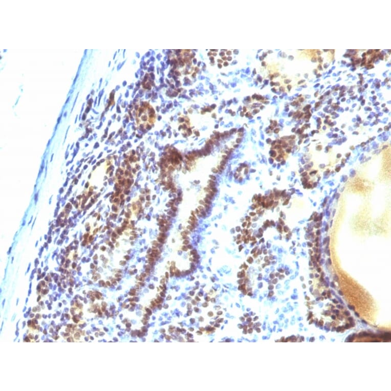 Immunohistochemistry - Anti-MAP3K1 Antibody [2F6] (A249314) - Antibodies.com