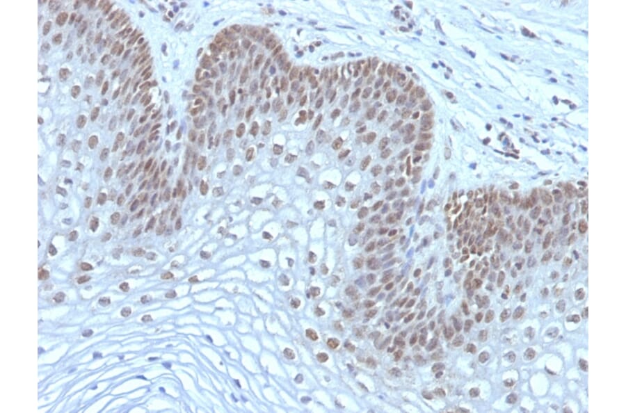 Immunohistochemistry - Anti-MAP3K1 Antibody [2F6] (A249313) - Antibodies.com
