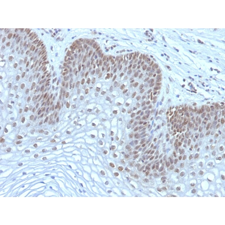 Immunohistochemistry - Anti-MAP3K1 Antibody [2F6] (A249313) - Antibodies.com